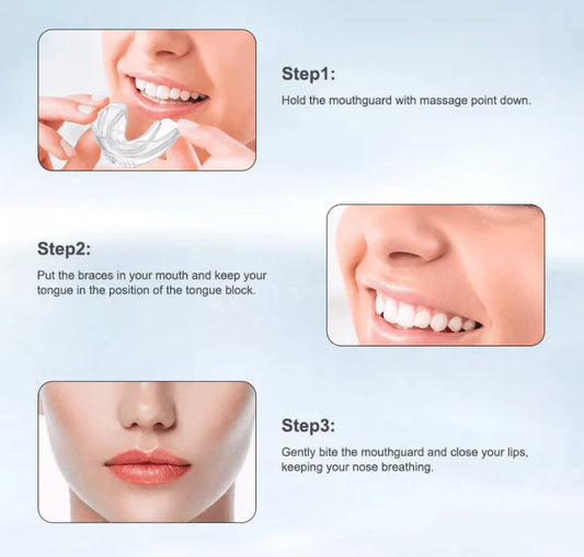 Invisible Braces